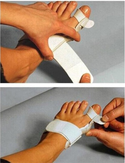 Hallux Valgus Corrector With Foot Valgus Separator - Image 8